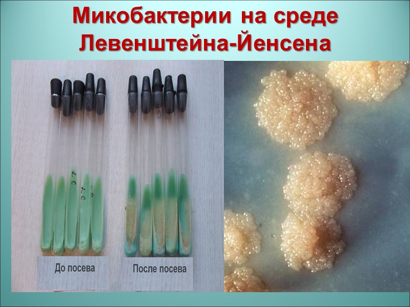 Микобактерии на среде Левенштейна-Йенсена